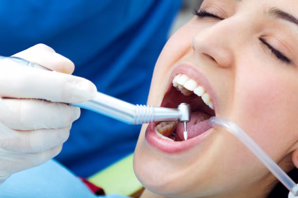 a lady having teeth whitening