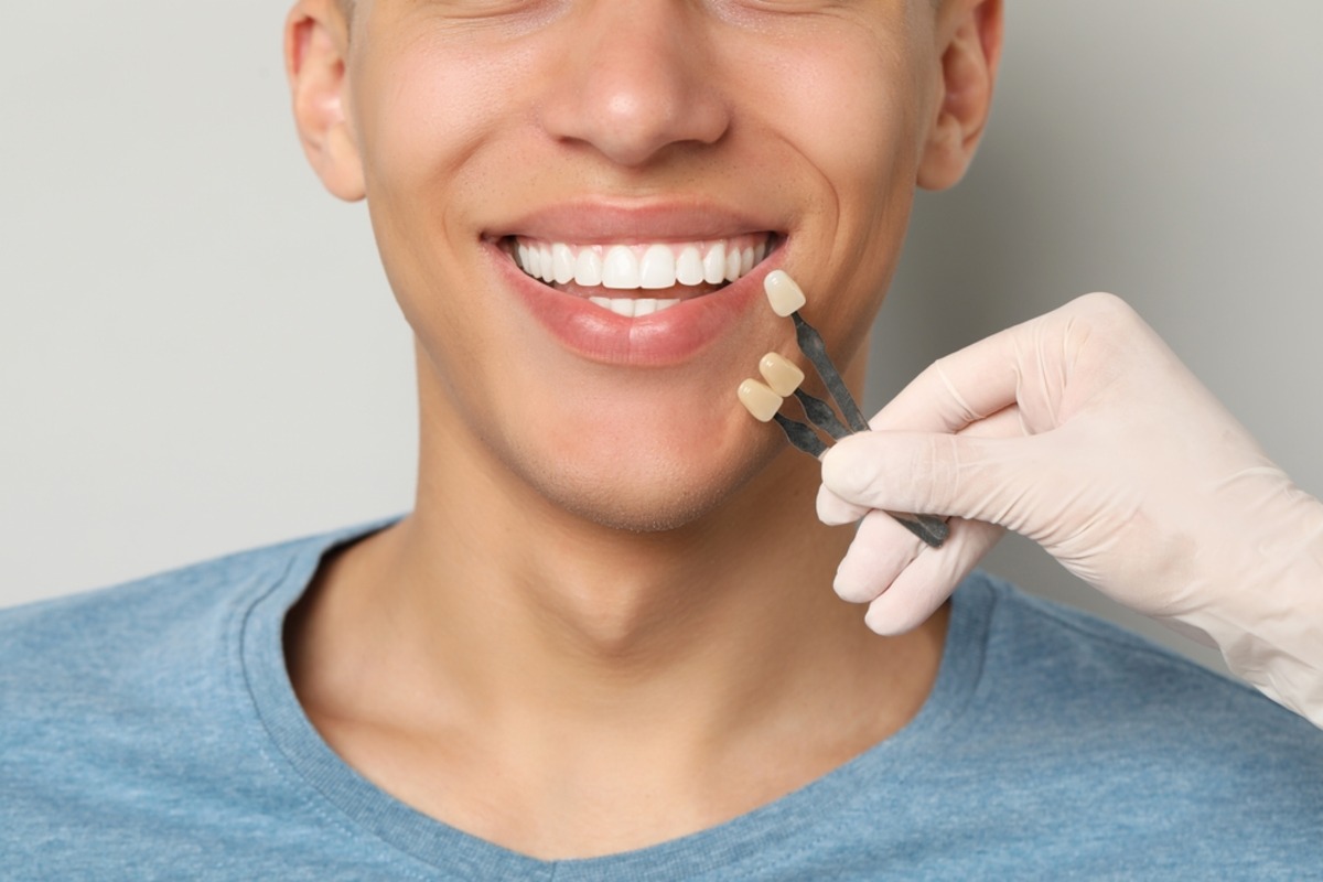 porcelain veneers treatment
