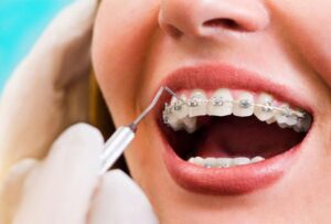 Achieving a Confident, Healthy Smile with Orthodontics