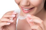 Invisalign vs. At-Home Clear Aligners: Which is Better?