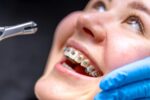 a lady is smiling after having orthodontics treatment